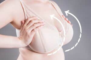 Woman in bra with large breasts that could benefit from breast reduction